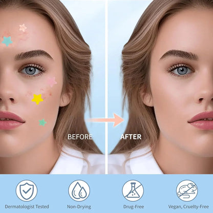 New Pimple Patch Acne Invisible Acne Removal Skin Care Stickers Concealer Face Spot Beauty Makeup Tools