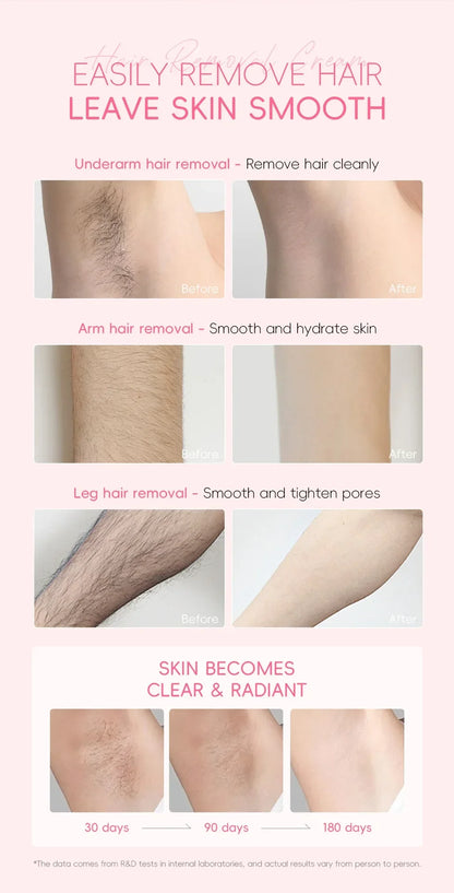 LAIKOU Hair Removal Cream For Men Women Body Intimate Areas Skin Care Moisturizing 50g