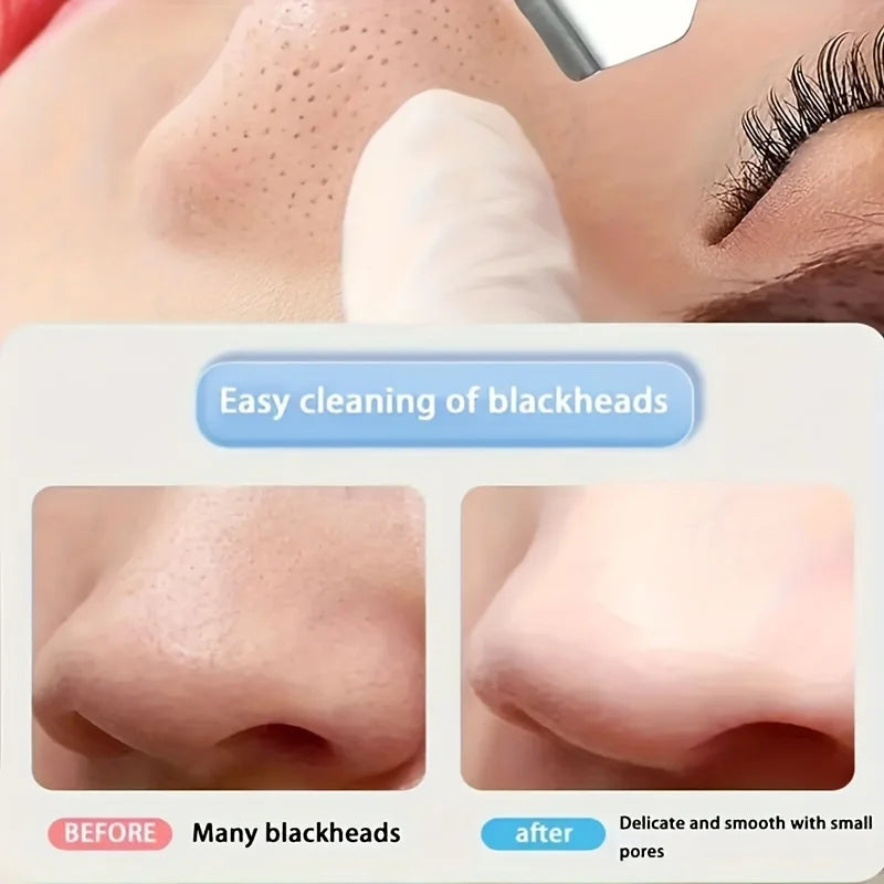 1Pcs Double-Ended Blackhead Remover: Facial Pore Cleanser, Exfoliator, and Massage Tool for Smooth Skin