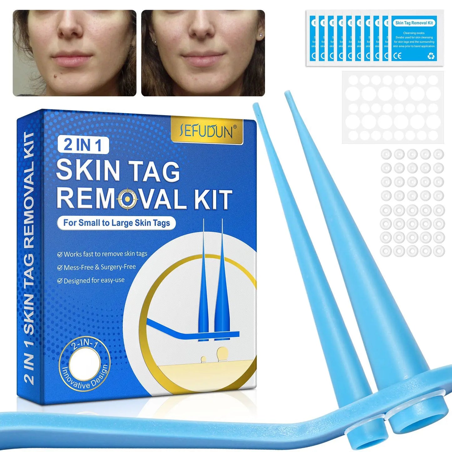 2 In 1 Auto Skin Tag Removal Kit Painless Mole Wart Remover Equipment Micro 1-9mm Treatment Tool Easy To Clean Skin Care Tool