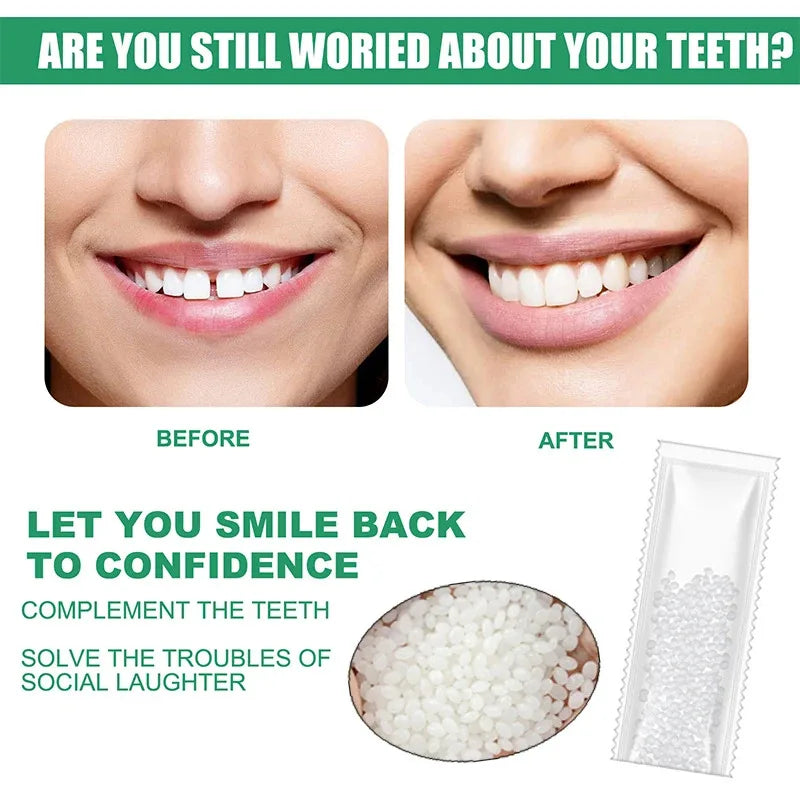 5-100g Resin Tooth Repair Glue Shapeable Teeth Gaps Filling Solid Glue Temporary Teeth Repair Falseteeth Safety Dental Supplies