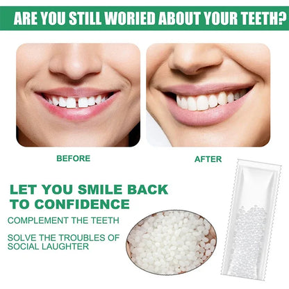 5-100g Resin Tooth Repair Glue Shapeable Teeth Gaps Filling Solid Glue Temporary Teeth Repair Falseteeth Safety Dental Supplies