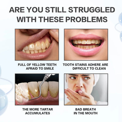 Nano Hydroxyapatite Toothpaste Remover Coffee Tea Stain Improve Bad Breath Prevent Caries Teeth Whitening Toothpaste Products