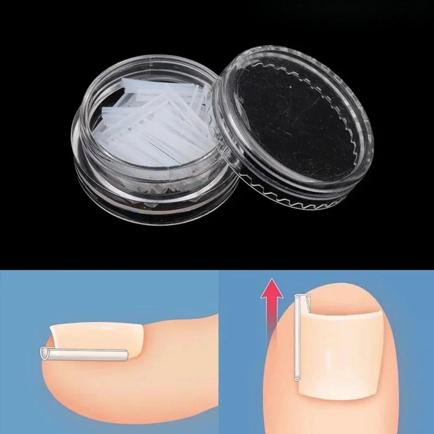 50Pcs Ingrown Toenail Correction Tool Ingrown Toe Nail Treatment Elastic Patch Sticker Straightening Clip Brace Pedicure Tool
