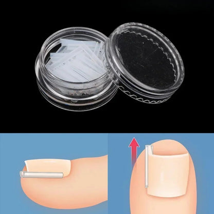 50Pcs Ingrown Toenail Correction Tool Ingrown Toe Nail Treatment Elastic Patch Sticker Straightening Clip Brace Pedicure Tool