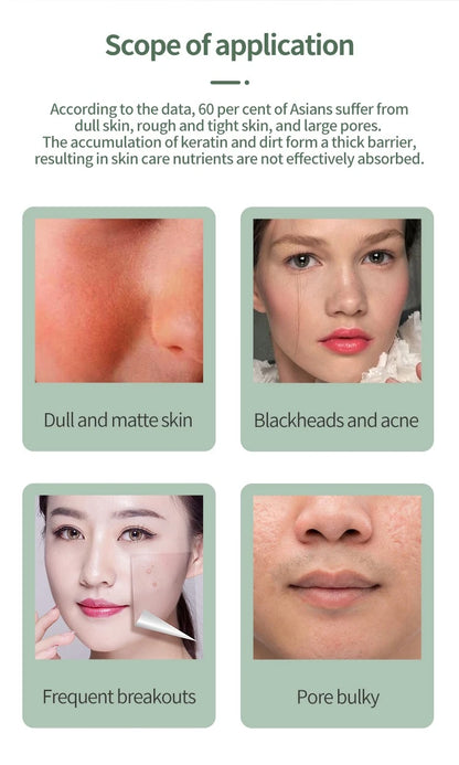 Deep Vibrate Skin Scrubber Facial Cleaner Shovel Spatula Not Ultrasonic Face ScrubberPeeling Blackhead Remover Facial Ma ssager