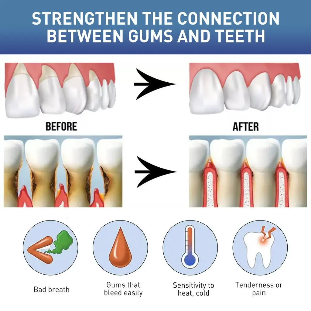 Rapid Repair Gums Gel Effectively Relieve Tooth Allergy Dental Caries Tooth Cleaning Toothpaste Relieve Tooth Damage Serum