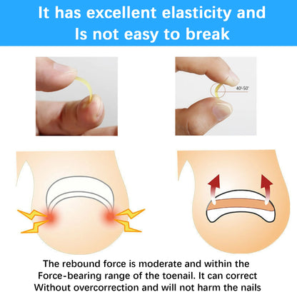 50Pcs Ingrown Toenail Correction Tool Ingrown Toe Nail Treatment Elastic Patch Sticker Straightening Clip Brace Pedicure Tool