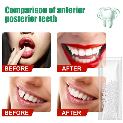 5-100g Resin Tooth Repair Glue Shapeable Teeth Gaps Filling Solid Glue Temporary Teeth Repair Falseteeth Safety Dental Supplies