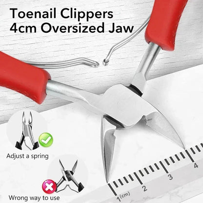 Professional Ingrown Toenail Corrector Kit – Podiatry-Grade Nail Clippers, Cuticle Nippers & Paronychia Care Tools
