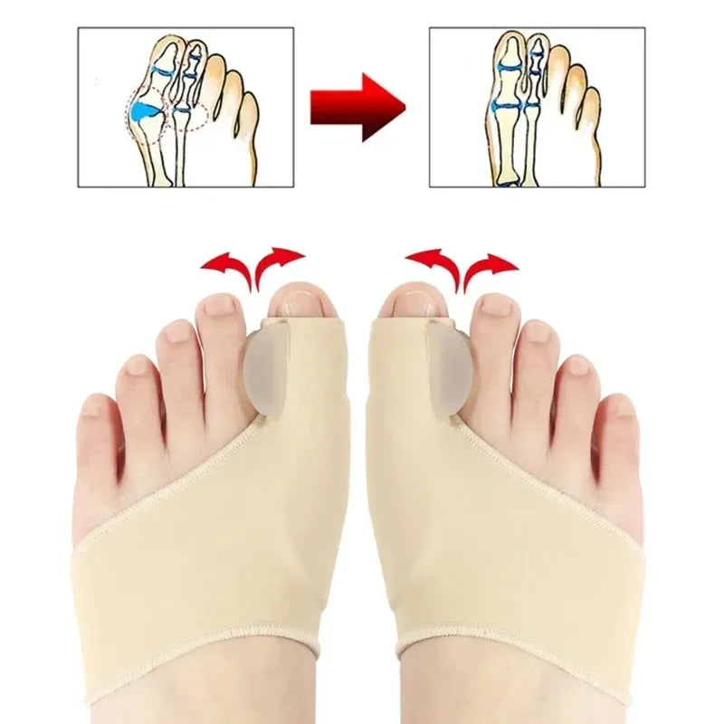 Hallux Valgus Bunion Corrector Orthotics Toe Separator - Feet Bone Thumb Adjuster Pedicure Sock Straightener for Foot Health