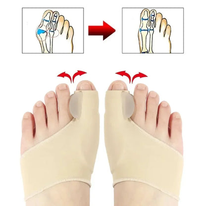 Hallux Valgus Bunion Corrector Orthotics Toe Separator - Feet Bone Thumb Adjuster Pedicure Sock Straightener for Foot Health