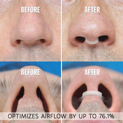 Silicone Nose Breathing Dilator, Nasal Clip for Snoring and Rhinitis, Easy Breathing Aid for Sleep Apnea
