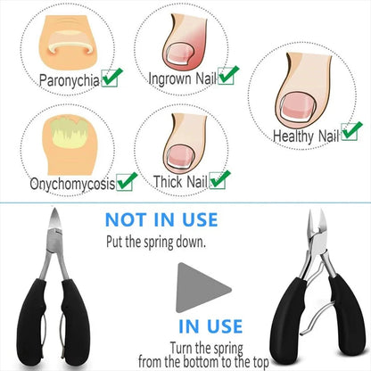 Toenail Clippers Nail Cutters Professional Pedicure Paronychia Tools Manicure Sets Stainless Steel Sharp Curved Blade Big Pliers