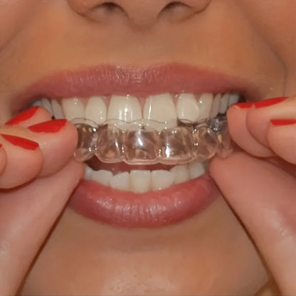 Silicone Mouth Guard Teeth Protector Night Guard Mouth Tray for Bruxism Grinding Non-snoring Teeth Whitening Protection