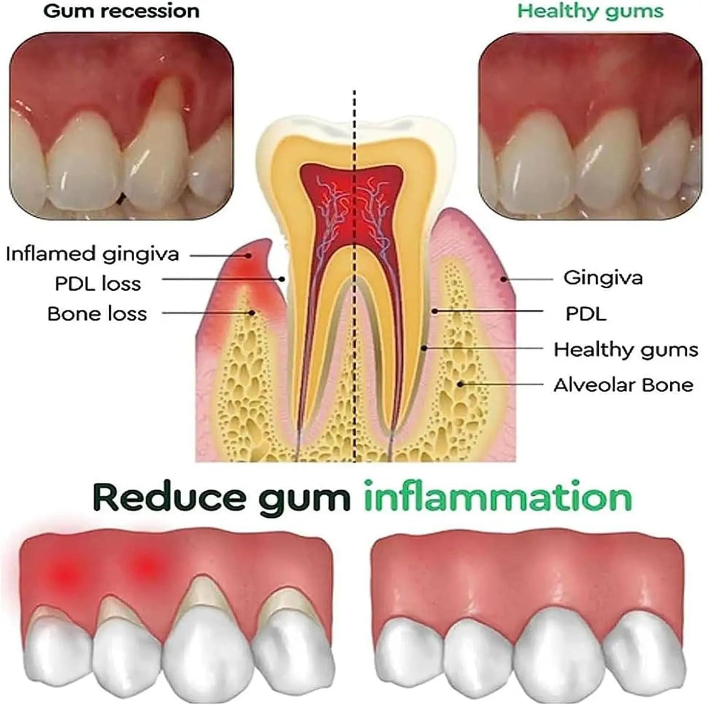 Rapid Repair Gums Gel Effectively Relieve Tooth Allergy Dental Caries Tooth Cleaning Toothpaste Relieve Tooth Damage Serum