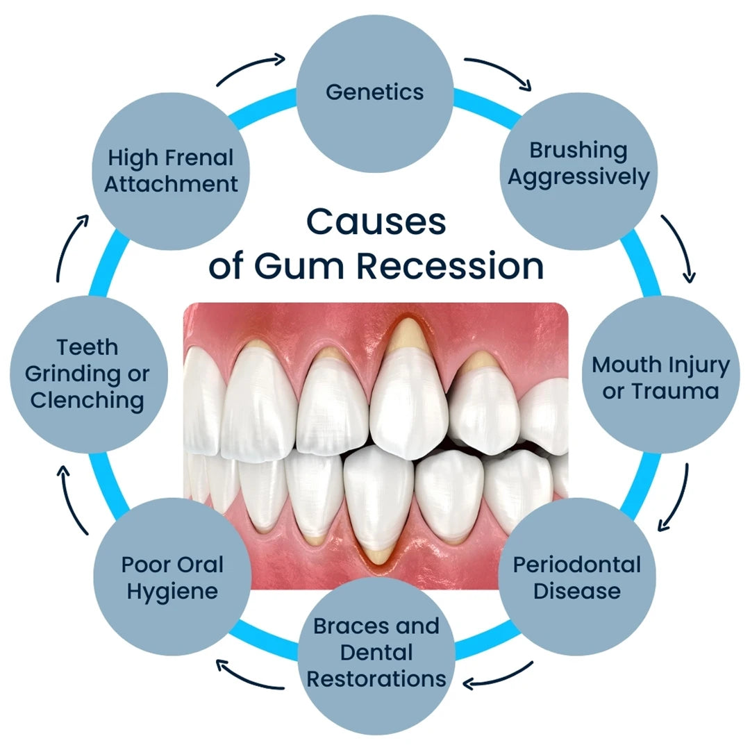 Rapid Repair Gums Gel Effectively Relieve Tooth Allergy Dental Caries Tooth Cleaning Toothpaste Relieve Tooth Damage Serum