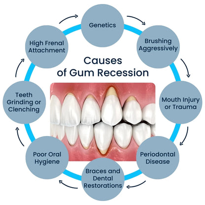 Rapid Repair Gums Gel Effectively Relieve Tooth Allergy Dental Caries Tooth Cleaning Toothpaste Relieve Tooth Damage Serum