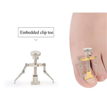 Correction of Paronychia with Toe Nail Correction Bracket for Treatment of Toe and Toe Care with Toe Fixator