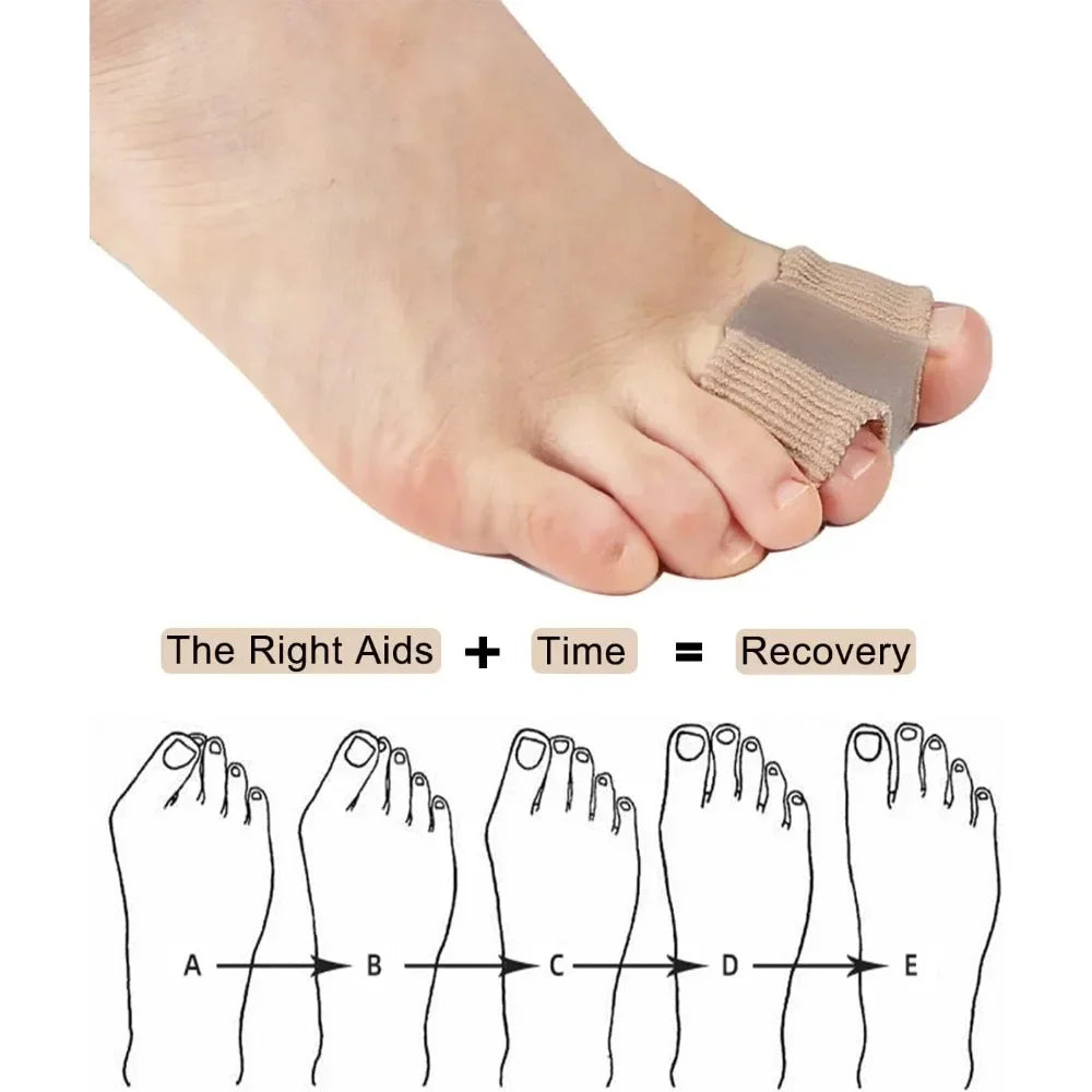 1/2Pc Two Toe Separator Hallux Valgus Bunion Corrector Orthotics Feet Bone Adjuster Thumb Straightener Pedicure Foot Care Tools