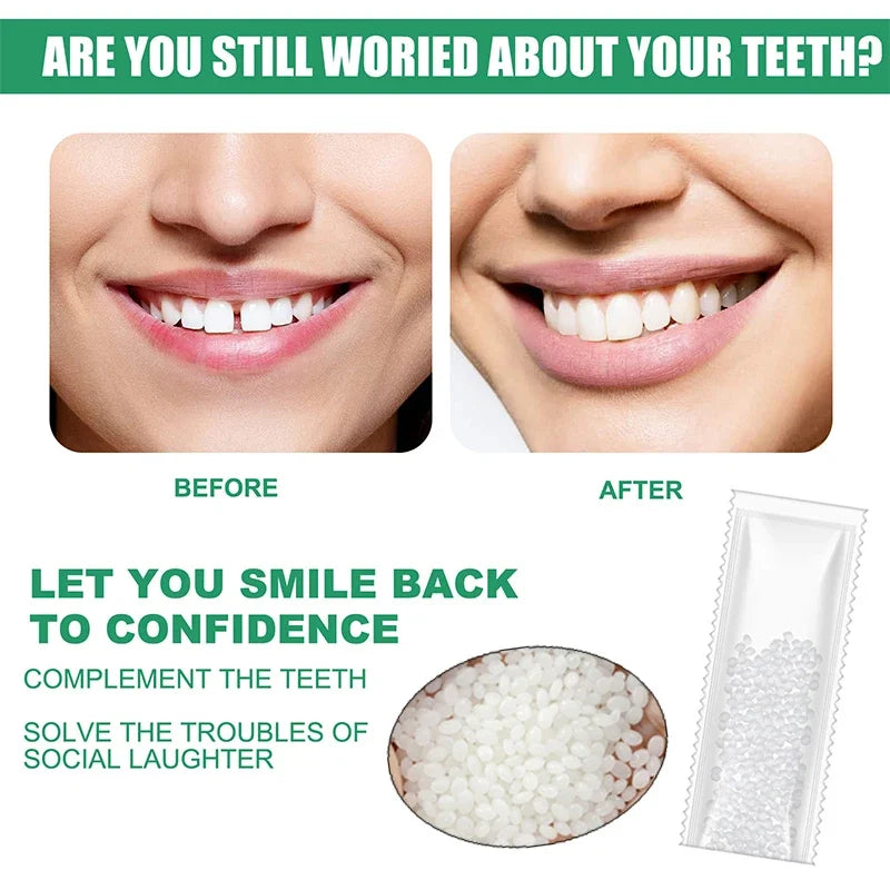 5-100g Resin Tooth Repair Glue Shapeable Teeth Gaps Filling Solid Glue Temporary Teeth Repair Falseteeth Safety Dental Supplies