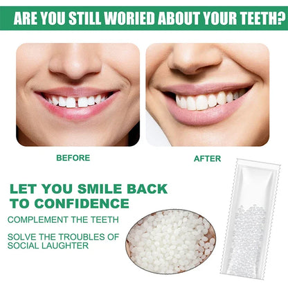 5-100g Resin Tooth Repair Glue Shapeable Teeth Gaps Filling Solid Glue Temporary Teeth Repair Falseteeth Safety Dental Supplies
