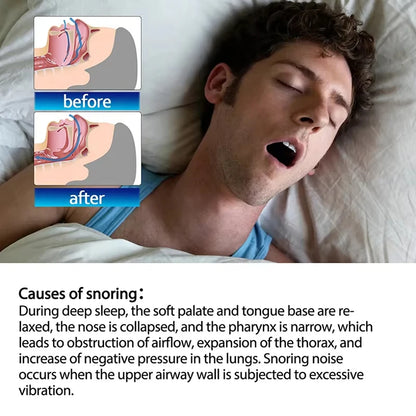 30pcs Mouth Tape For Sleep Apnea Mouth Tape Mouth Tape For Sleeping Snoring Mouth Breathing Tape Breathing Mouth Tape
