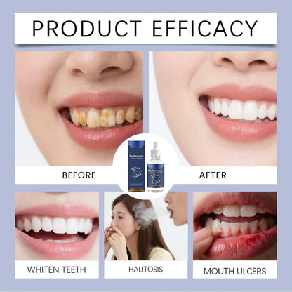 60ml Teeth Cleaning Liquid Removes Tooth Stains Teeth Whitening Tooth For Women Gum Care Decay Cleaning Health Relief Repair