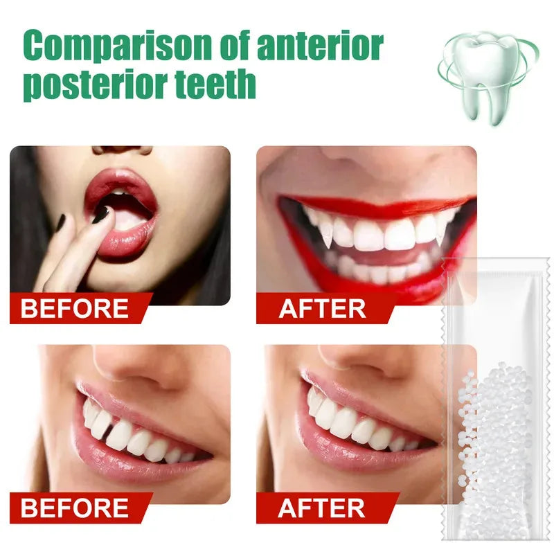 5-100g Resin Tooth Repair Glue Shapeable Teeth Gaps Filling Solid Glue Temporary Teeth Repair Falseteeth Safety Dental Supplies