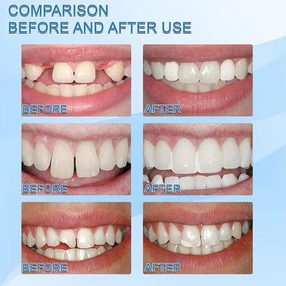 5-100g Resin Tooth Repair Glue Shapeable Teeth Gaps Filling Solid Glue Temporary Teeth Repair Falseteeth Safety Dental Supplies