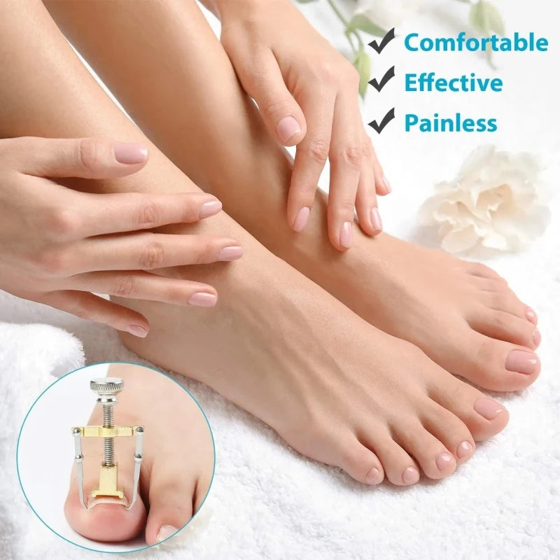 Correction of Paronychia with Toe Nail Correction Bracket for Treatment of Toe and Toe Care with Toe Fixator