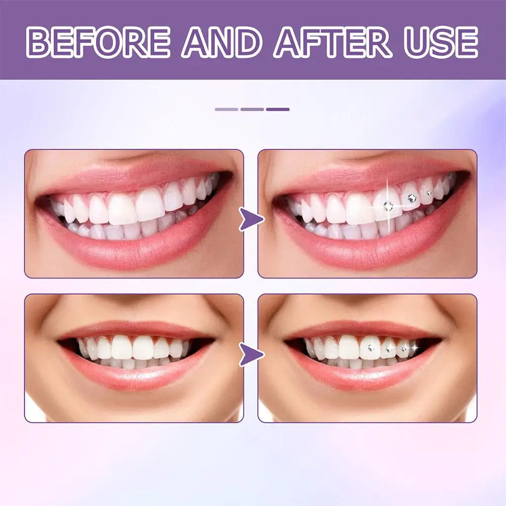 EELHOE Tooth Gem Glue Dental Adhesive for Tooth Gems Diamond Kit Glue Teeth Crystal Jewelry Sturdy Tooth Jewelry Orthodontic Gel