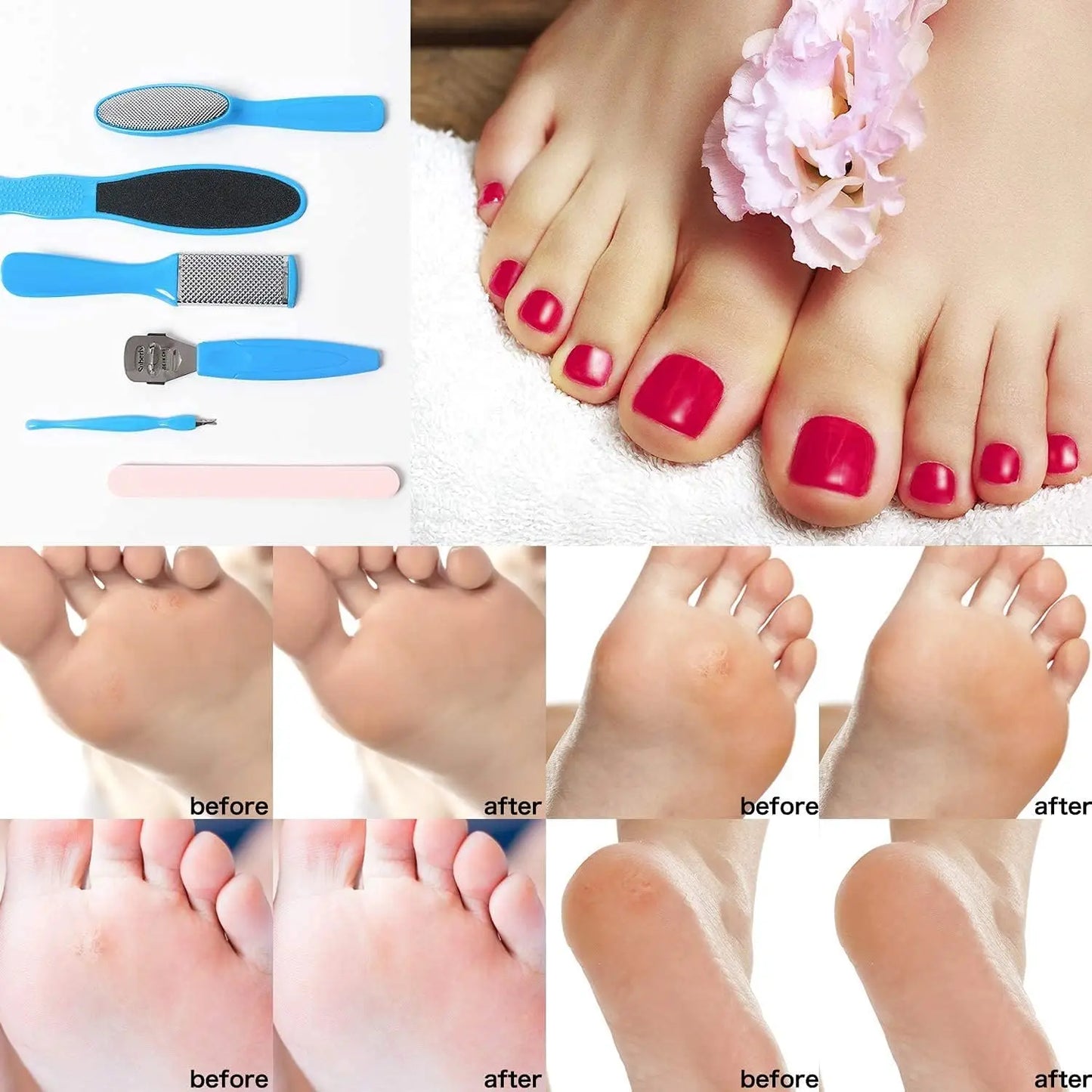 8 Piece Set Foot Octopus Fish Eye Exfoliating Heel Sharpener Heel Cramping Heel Cramping Heel Crackles Removal Files Heel Sole