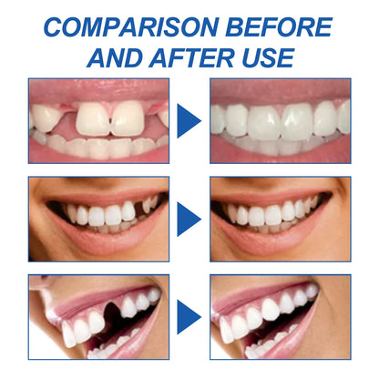 Resin Temporary Tooth Repair Granules Teeth Gaps Missing Broken Tooth Filling Moldable Adhesive Dentures False Teeth Tools
