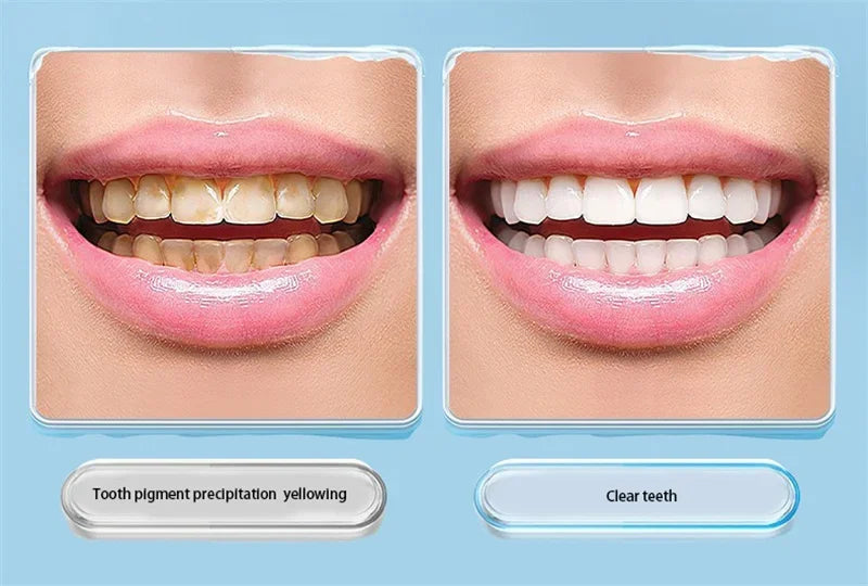 1/3/5PCS Teeth Stain Eraser Sponge Remover Tartar/Tea/ Smoke Stains Orthodontic Toothbrush Oral Care Interdental Brush Teeth