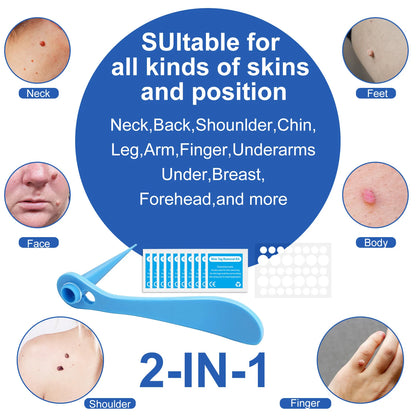 2 In 1 Auto Skin Tag Removal Kit Painless Mole Wart Remover Equipment Micro 1-9mm Treatment Tool Easy To Clean Skin Care Tool