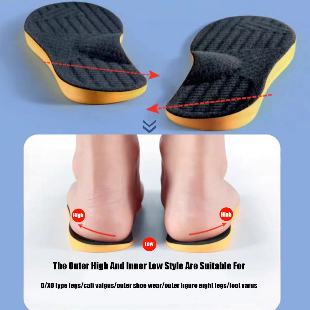 2026 Orthotic Insole For Flat Feet Arch Support Orthopedic Shoes Sole Insoles For Feet Men Women O/X Leg Corrected Care Pad