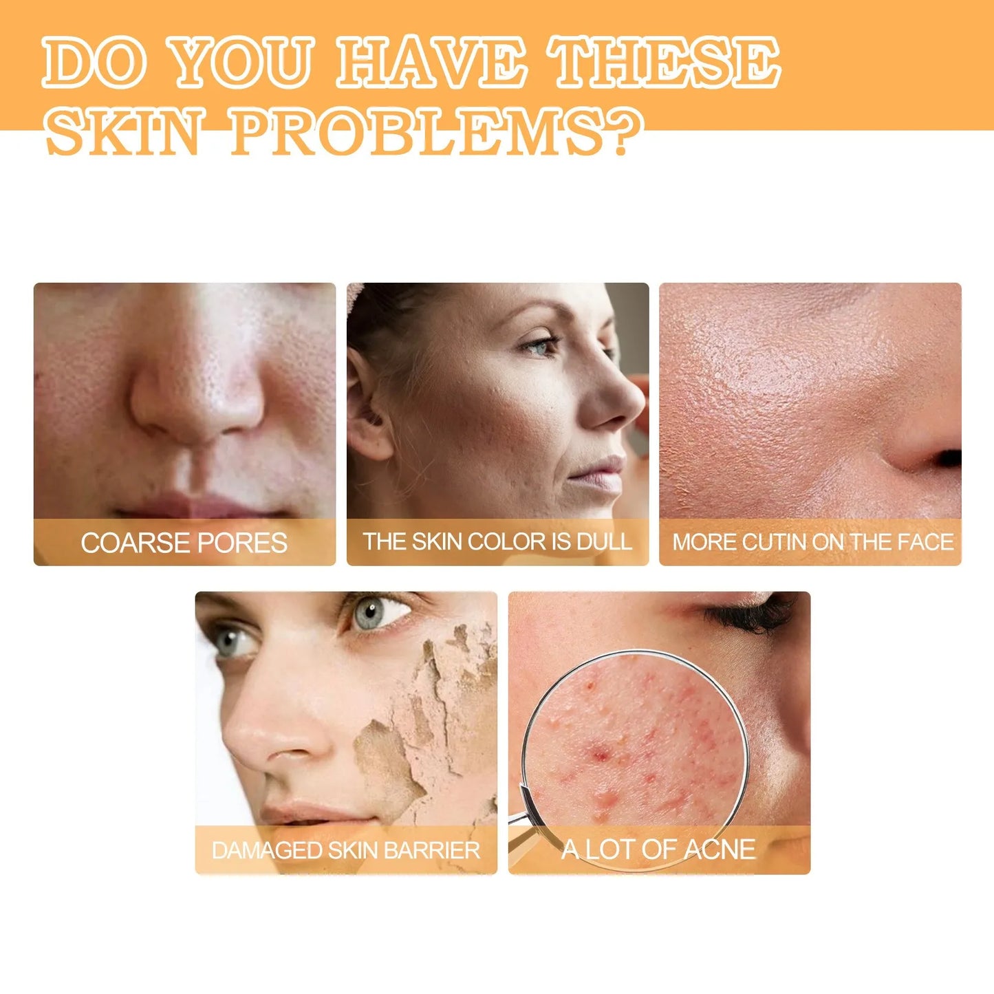 Glycolic Acid 7% Toning Solution Ordinary Acne Remover Lifting Firming Wrinkles Glowing Facial Skin Care Glycolic Acid Toner