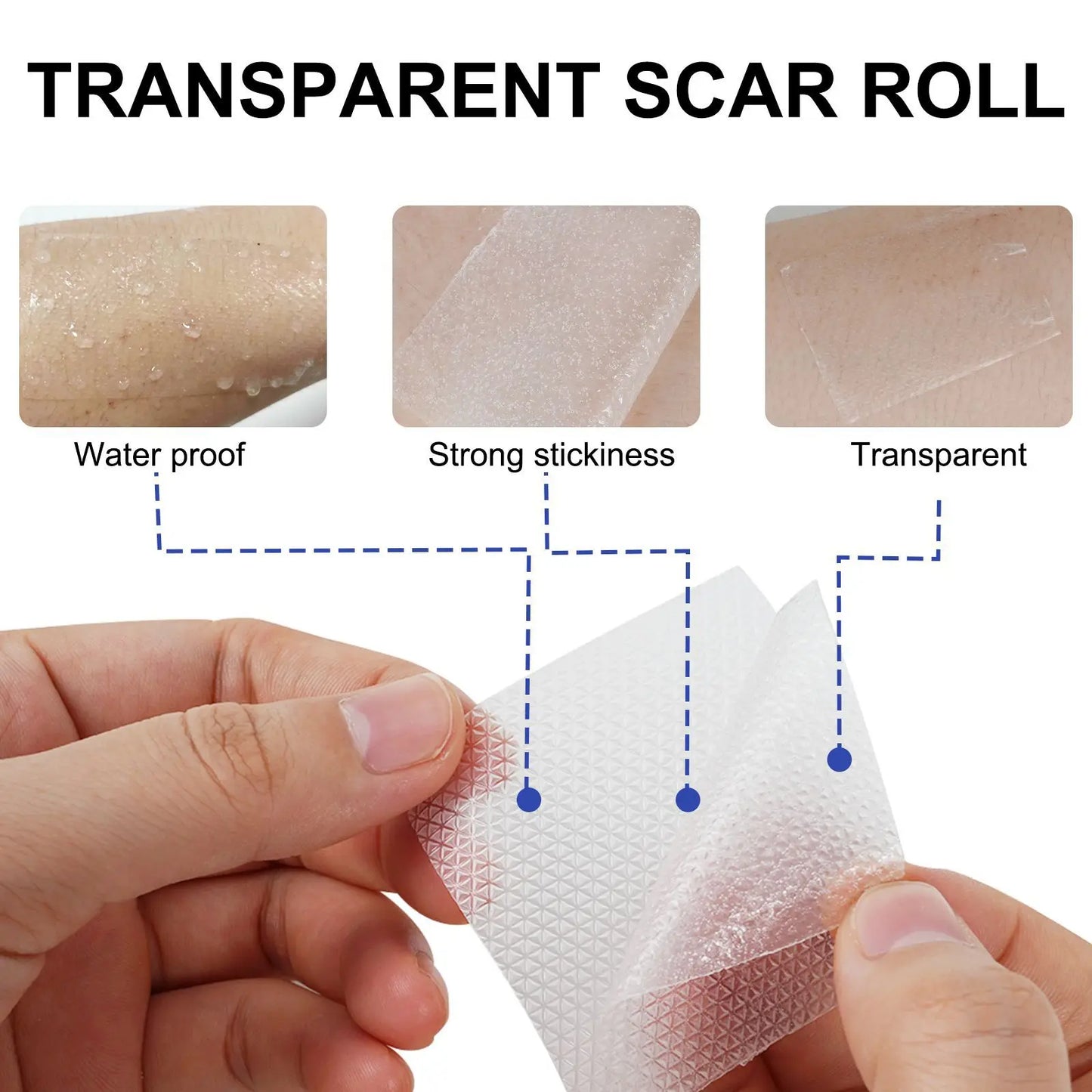1 Roll Invisible Silicone Scar Sheets Self-Adhesive Scar Cover Tape Skin Care Strips Transparent Color