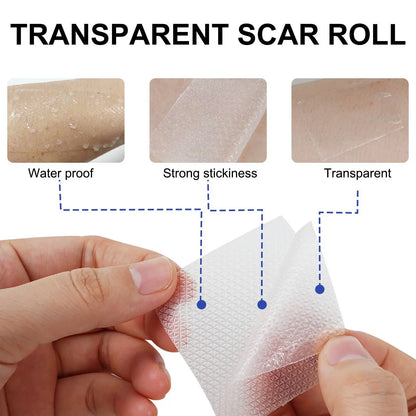 1 Roll Invisible Silicone Scar Sheets Self-Adhesive Scar Cover Tape Skin Care Strips Transparent Color
