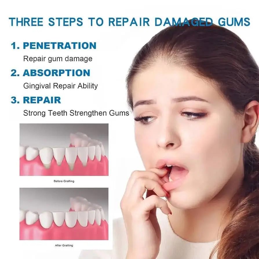 Rapid Repair Gums Gel Effectively Relieve Tooth Allergy Dental Caries Tooth Cleaning Toothpaste Relieve Tooth Damage Serum