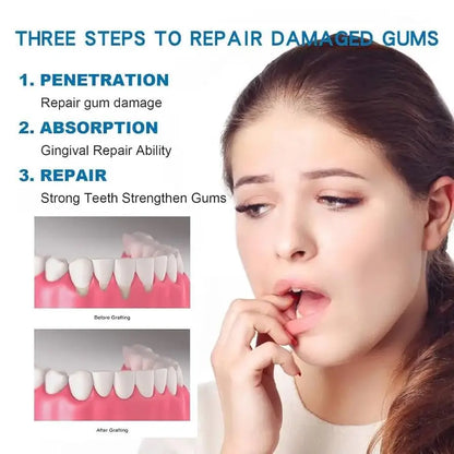 Rapid Repair Gums Gel Effectively Relieve Tooth Allergy Dental Caries Tooth Cleaning Toothpaste Relieve Tooth Damage Serum