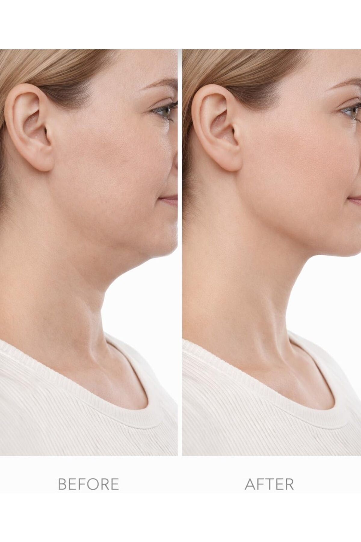 PUREGLAM Lenf Drenaj Fırçası